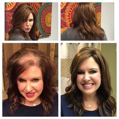 hairstyles-for-thinning-hair-in-front-woman-11_19 Hairstyles for thinning hair in front woman